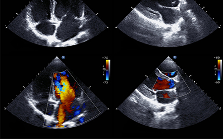 Cardiac Sonography image